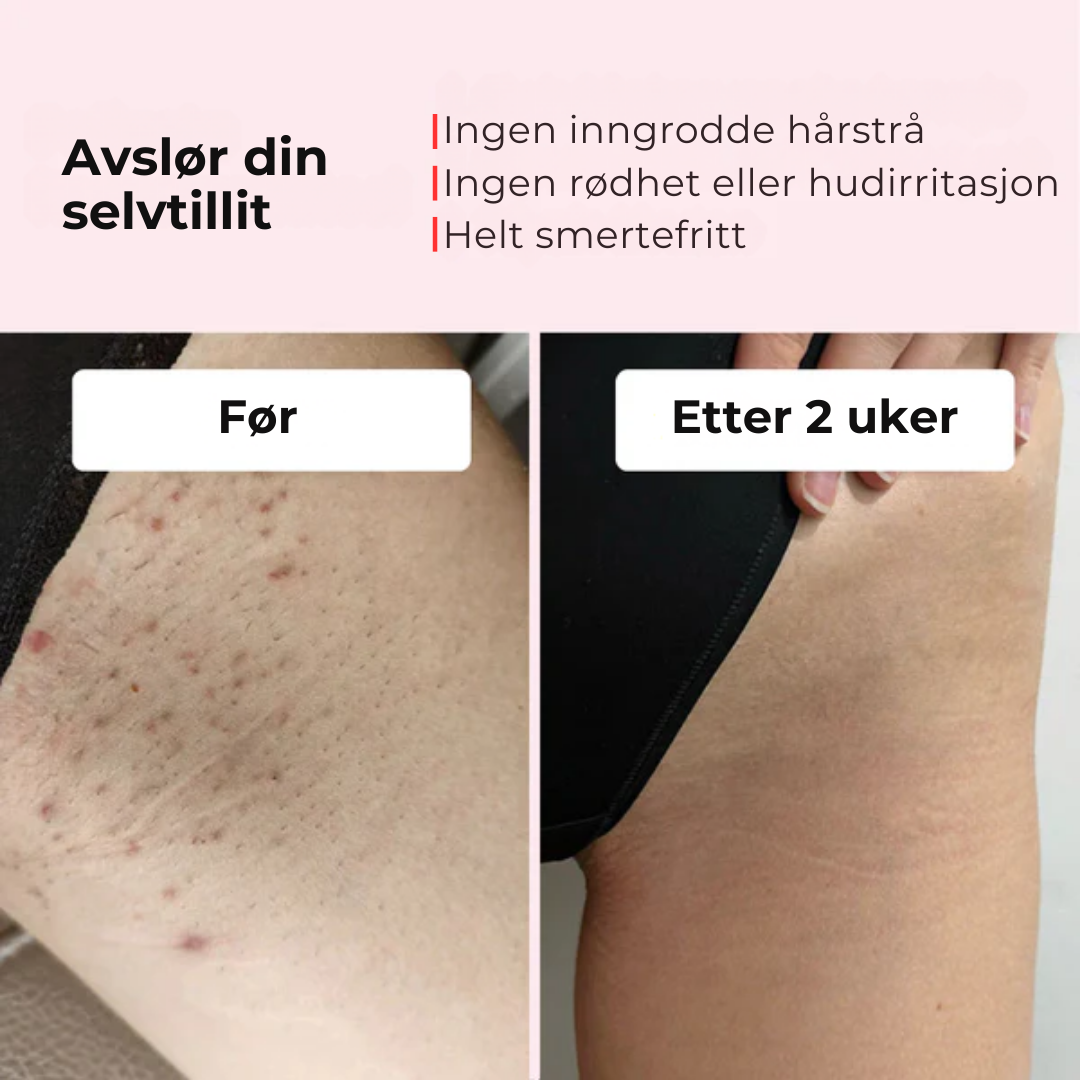 Smoothly™ | Glatt hud som varer