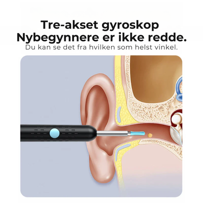 VisionEar™ Smart Camera | Når du endelig kan SE hva som skjer i øret