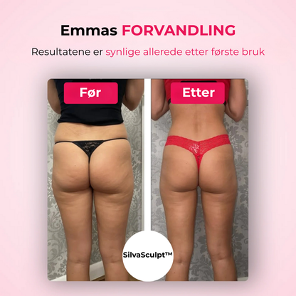 SilvaSculpt™ | Din hjemmehemmelighet mot cellulitter og slapp hud